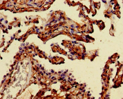 Immunohistochemistry (Formalin/PFA-fixed paraffin-embedded sections) - Anti-Mannosidase II/MAN2A1 antibody (AB224611), expandable thumbnail