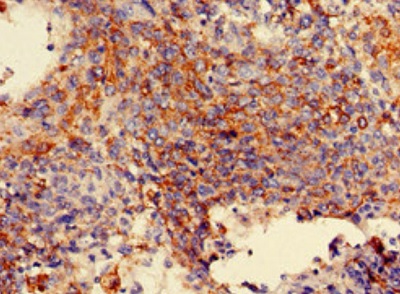 Immunohistochemistry (Formalin/PFA-fixed paraffin-embedded sections) - Anti-Mannosidase II/MAN2A1 antibody (AB224611), expandable thumbnail