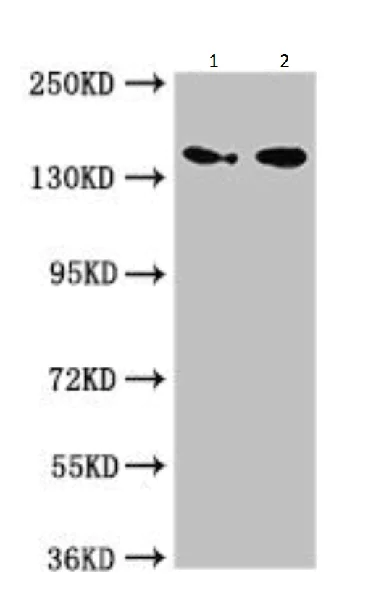 Western blot - Anti-Mannosidase II/MAN2A1 antibody (AB224611)