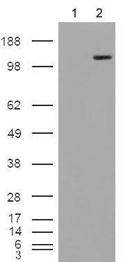 Western blot - Anti-Mannosidase II/MAN2A1 antibody (AB77353)