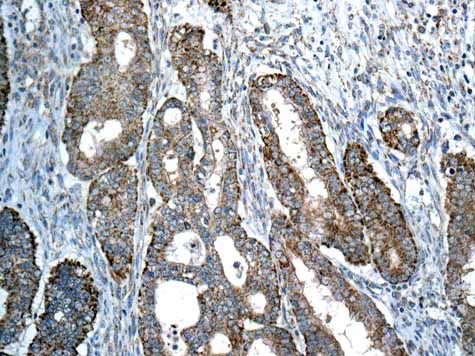 Immunohistochemistry (Formalin/PFA-fixed paraffin-embedded sections) - Anti-Map17 antibody [EPR10372] (AB156014)