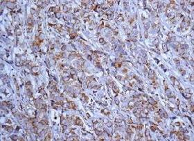 Immunohistochemistry (Formalin/PFA-fixed paraffin-embedded sections) - Anti-Map17 antibody [EPR10372] - BSA and Azide free (AB249253)