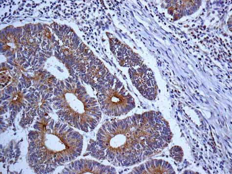 Immunohistochemistry (Formalin/PFA-fixed paraffin-embedded sections) - Anti-Map17 antibody [EPR10372] - BSA and Azide free (AB249253)