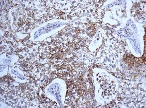Immunohistochemistry (Formalin/PFA-fixed paraffin-embedded sections) - Anti-Map17 antibody [EPR10372] - BSA and Azide free (AB249253)