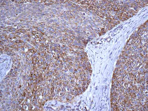 Immunohistochemistry (Formalin/PFA-fixed paraffin-embedded sections) - Anti-Map17 antibody [EPR10372] - BSA and Azide free (AB249253)