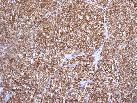 Immunohistochemistry (Formalin/PFA-fixed paraffin-embedded sections) - Anti-Map17 antibody [EPR10372] - BSA and Azide free (AB249253)