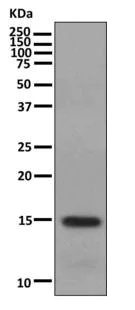 Western blot - Anti-Map17 antibody [EPR10372] - BSA and Azide free (AB249253)