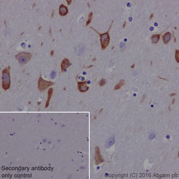 Immunohistochemistry (Formalin/PFA-fixed paraffin-embedded sections) - Anti-MAP1A antibody [EPR18993] (AB184349)