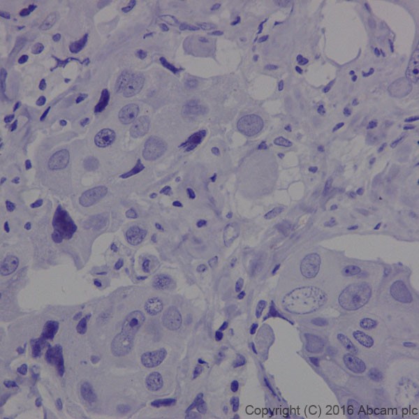 Immunohistochemistry (Formalin/PFA-fixed paraffin-embedded sections) - Anti-MAP1A antibody [EPR18993] (AB184349)
