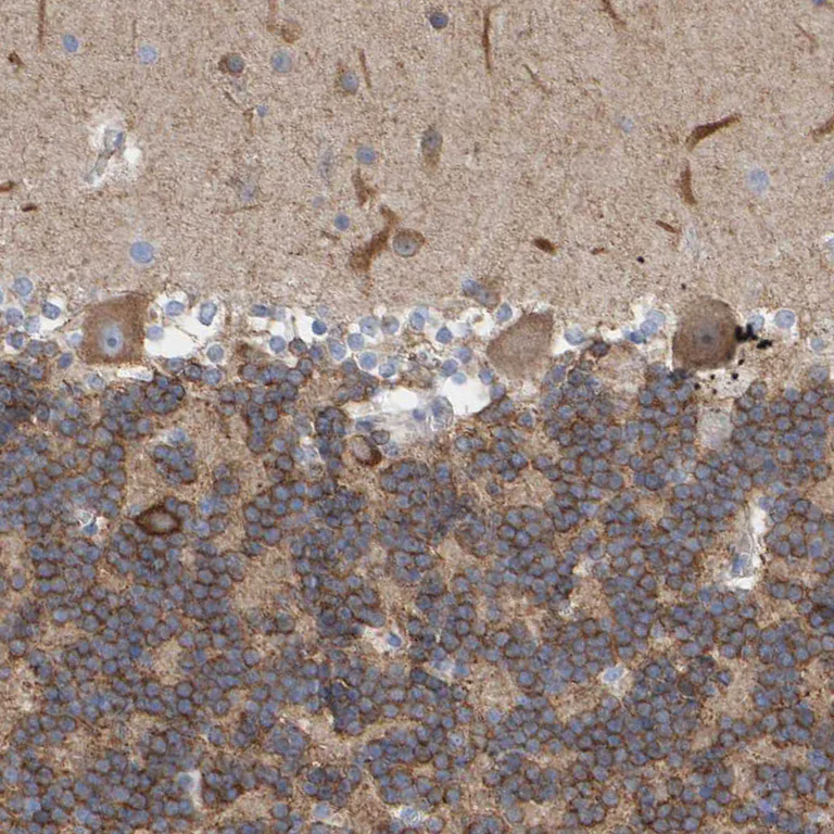 Immunohistochemistry (Formalin/PFA-fixed paraffin-embedded sections) - Anti-MAP1B antibody (AB224115)