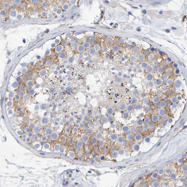 Immunohistochemistry (Formalin/PFA-fixed paraffin-embedded sections) - Anti-MAP1B antibody (AB224115)