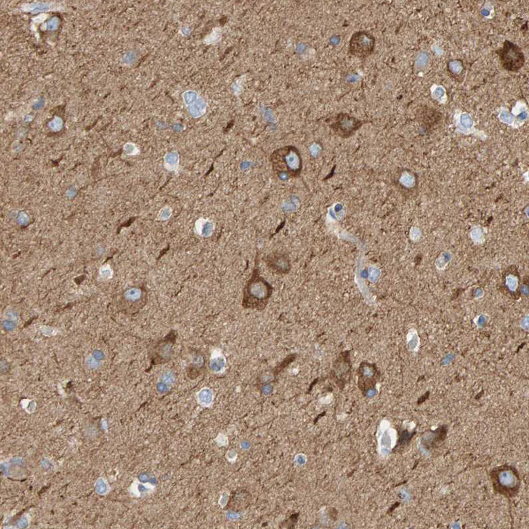 Immunohistochemistry (Formalin/PFA-fixed paraffin-embedded sections) - Anti-MAP1B antibody (AB224115)
