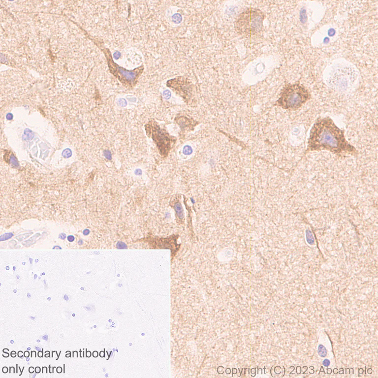 Immunohistochemistry (Formalin/PFA-fixed paraffin-embedded sections) - Anti-MAP1B antibody [EPR27224-93] (AB315226)