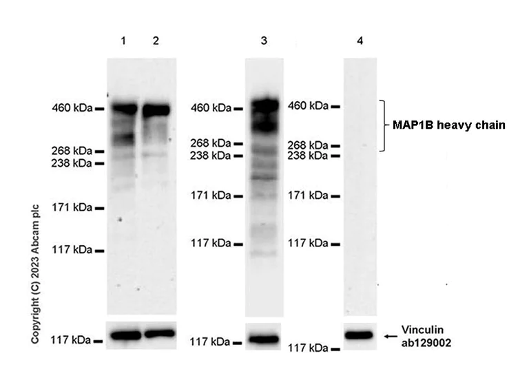 Western blot - Anti-MAP1B antibody [EPR27224-93] (AB315226)