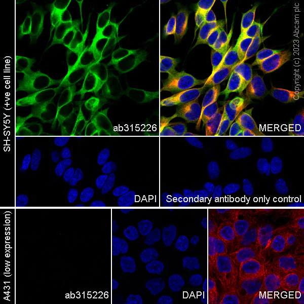 Immunocytochemistry/ Immunofluorescence - Anti-MAP1B antibody [EPR27224-93] - BSA and Azide free (AB315227)