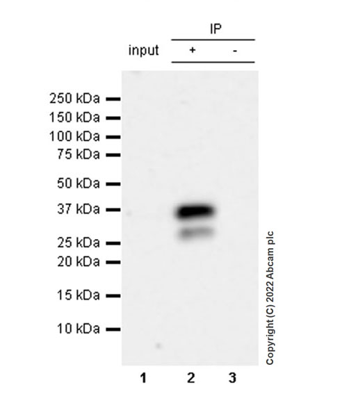 Immunoprecipitation - Anti-MAP1B antibody [EPR27225-25] - BSA and Azide free (AB307287), expandable thumbnail