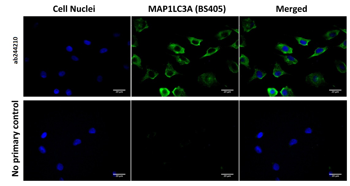 Immunocytochemistry/ Immunofluorescence - Anti-MAP1LC3A antibody [BS405] (AB244210), expandable thumbnail