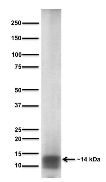 Western blot - Anti-MAP1LC3A antibody [BS405] (AB244210), expandable thumbnail