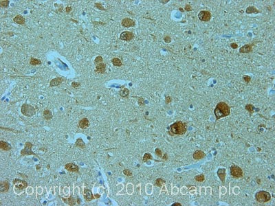 Immunohistochemistry (Formalin/PFA-fixed paraffin-embedded sections) - Anti-MAP1LC3A antibody [EP1528Y] (AB52628), expandable thumbnail