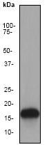 Western blot - Anti-MAP1LC3A antibody [EP1528Y] - Autophagosome Marker (AB52628), expandable thumbnail
