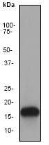 Western blot - Anti-MAP1LC3A antibody [EP1528Y] - Autophagosome Marker (AB52628)
