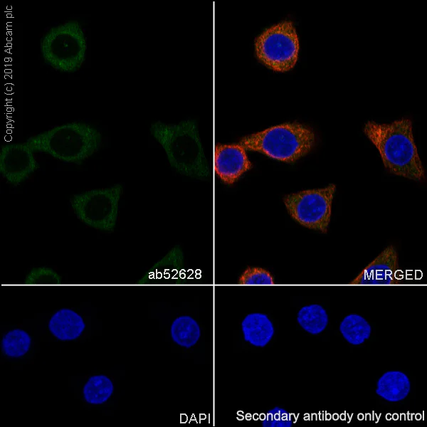 Immunocytochemistry/ Immunofluorescence - Anti-MAP1LC3A antibody [EP1528Y] - BSA and Azide free (AB247327)