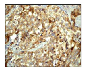 Immunohistochemistry (Formalin/PFA-fixed paraffin-embedded sections) - Anti-MAP1LC3A antibody [EP1983Y] - Autophagosome Marker (AB52768), expandable thumbnail