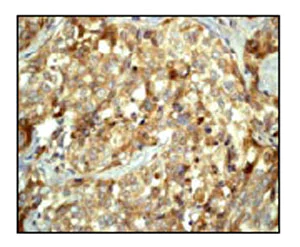 Immunohistochemistry (Formalin/PFA-fixed paraffin-embedded sections) - Anti-MAP1LC3A antibody [EP1983Y] - Autophagosome Marker (AB52768)