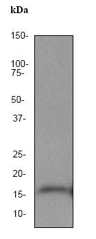 Western blot - Anti-MAP1LC3A antibody [EP1983Y] - Autophagosome Marker (AB52768)