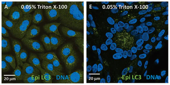 Immunocytochemistry/ Immunofluorescence - Anti-MAP1LC3A antibody [EP1983Y] - BSA and Azide free (AB239849)