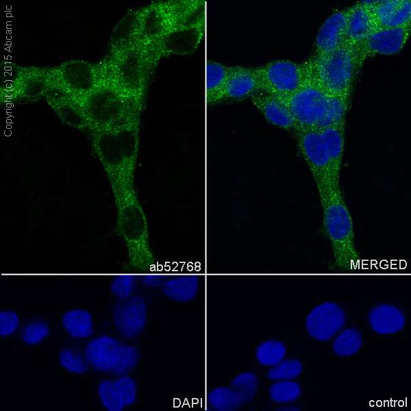 Immunocytochemistry/ Immunofluorescence - Anti-MAP1LC3A antibody [EP1983Y] - BSA and Azide free (AB239849)