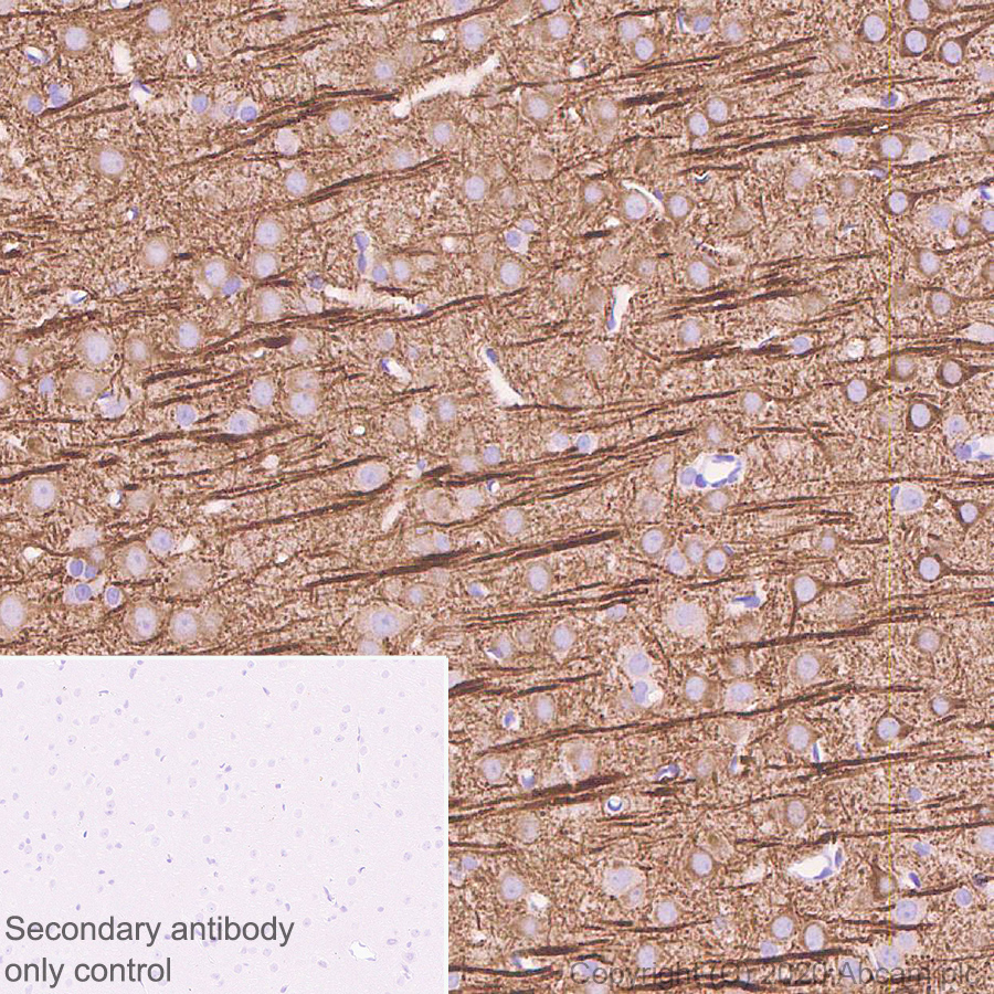 Immunohistochemistry (Formalin/PFA-fixed paraffin-embedded sections) - Anti-MAP2 antibody [AA5] (AB254143), expandable thumbnail