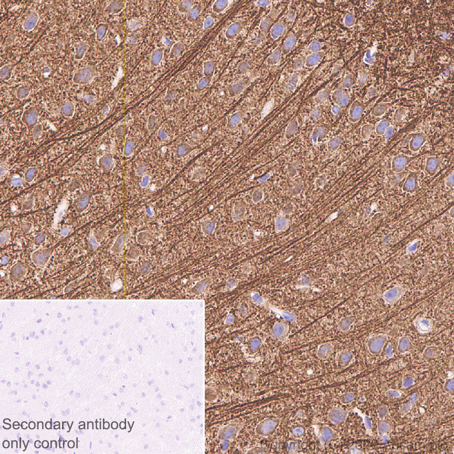 Immunohistochemistry (Formalin/PFA-fixed paraffin-embedded sections) - Anti-MAP2 antibody [AA5] (AB254143), expandable thumbnail