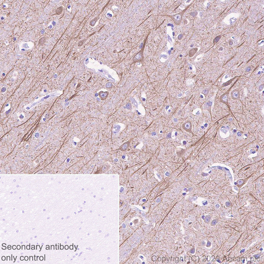 Immunohistochemistry (Formalin/PFA-fixed paraffin-embedded sections) - Anti-MAP2 antibody [AA5] (AB254143), expandable thumbnail