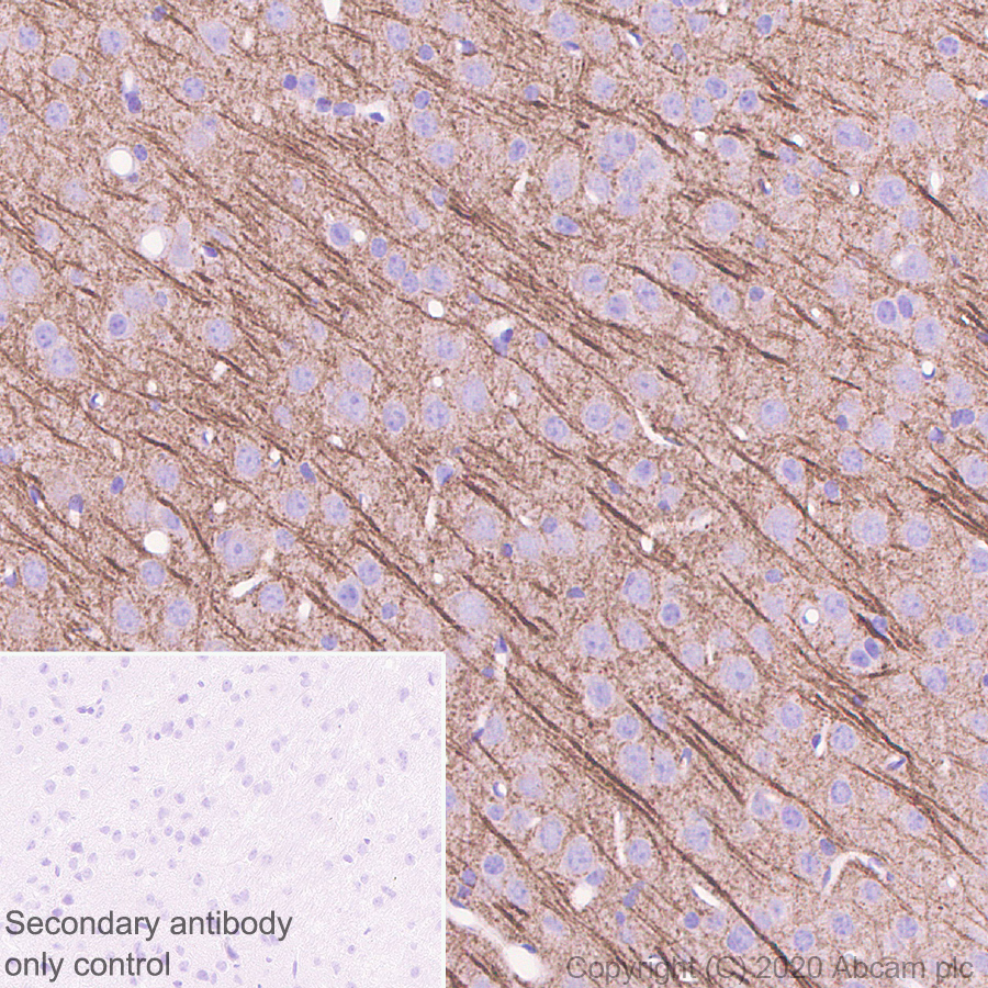 Immunohistochemistry (Formalin/PFA-fixed paraffin-embedded sections) - Anti-MAP2 antibody [AA6] - Neuronal Marker (AB254144), expandable thumbnail