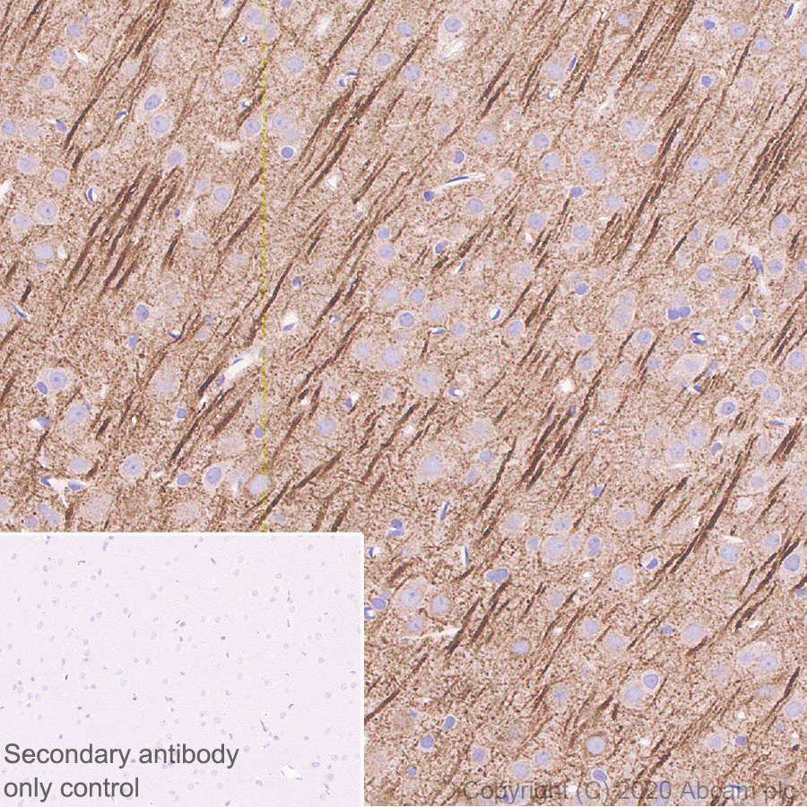 Immunohistochemistry (Formalin/PFA-fixed paraffin-embedded sections) - Anti-MAP2 antibody [AA6] - Neuronal Marker (AB254144), expandable thumbnail