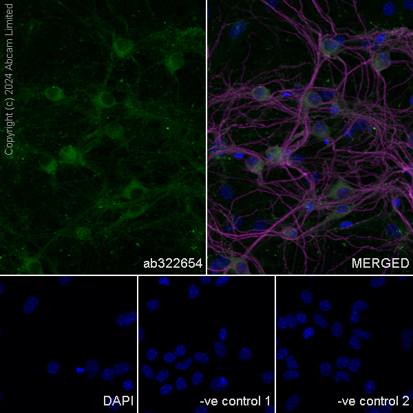 Immunocytochemistry/ Immunofluorescence - Anti-MAP2 antibody (ab5392), expandable thumbnail
