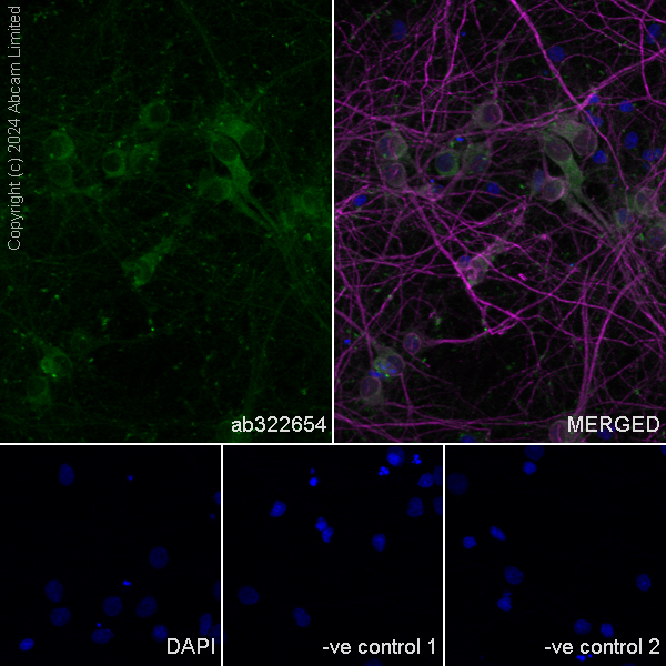 Immunocytochemistry/ Immunofluorescence - Anti-MAP2 antibody (ab5392), expandable thumbnail