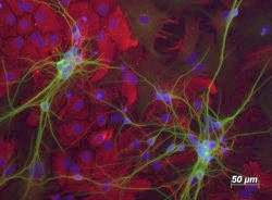 Immunocytochemistry/ Immunofluorescence - Anti-MAP2 antibody (AB75713), expandable thumbnail