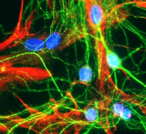 Immunocytochemistry/ Immunofluorescence - Anti-MAP2 antibody (AB75713), expandable thumbnail