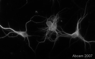 Immunocytochemistry/ Immunofluorescence - Anti-MAP2 antibody [AP-20] - Neuronal Marker (AB11268), expandable thumbnail