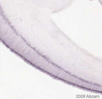 Immunohistochemistry (Formalin/PFA-fixed paraffin-embedded sections) - Anti-MAP2 antibody [AP-20] - Neuronal Marker (AB11268), expandable thumbnail