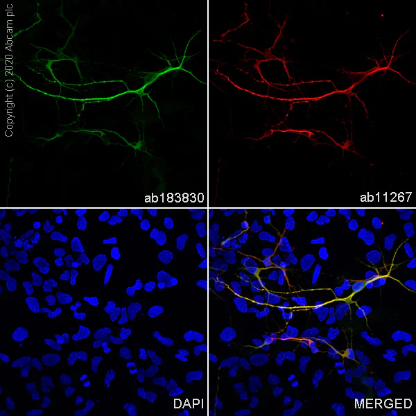 Immunocytochemistry/ Immunofluorescence - Anti-MAP2 antibody [EPR19691] - BSA and Azide free (AB236033)