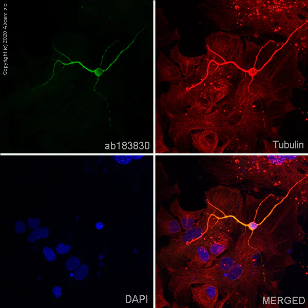 Immunocytochemistry/ Immunofluorescence - Anti-MAP2 antibody [EPR19691] - BSA and Azide free (AB236033)