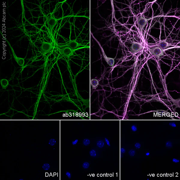 Immunocytochemistry/ Immunofluorescence - Anti-MAP2 antibody [EPR19691] - Chicken IgY (Chimeric) - BSA and Azide free (AB318994)