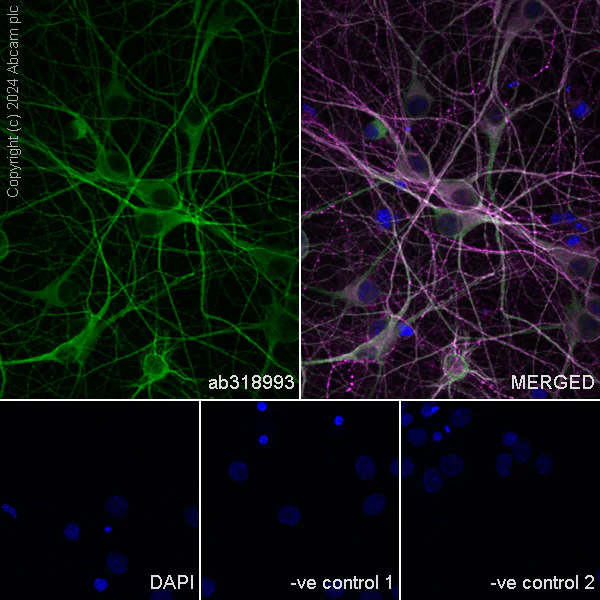 Immunocytochemistry/ Immunofluorescence - Anti-MAP2 antibody [EPR19691] - Chicken IgY (Chimeric) - BSA and Azide free (AB318994)