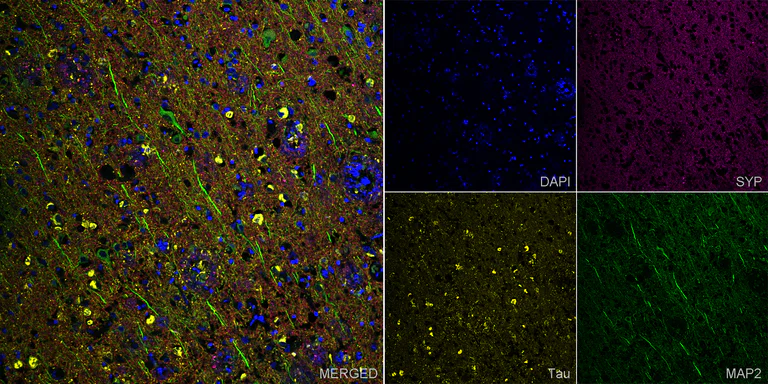 Immunohistochemistry (Formalin/PFA-fixed paraffin-embedded sections) - Anti-MAP2 antibody [EPR19691] - Chicken IgY (Chimeric) - BSA and Azide free (AB318994)