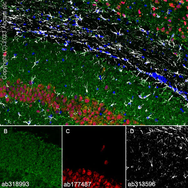 Immunohistochemistry (Frozen sections) - Anti-MAP2 antibody [EPR19691] - Chicken IgY (Chimeric) - BSA and Azide free (AB318994)