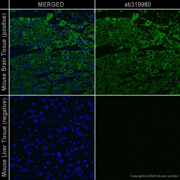 Immunohistochemistry (Formalin/PFA-fixed paraffin-embedded sections) - Anti-MAP2 antibody [EPR19691] – Chicken IgY (Chimeric) – BSA and Azide Free (AB319980)