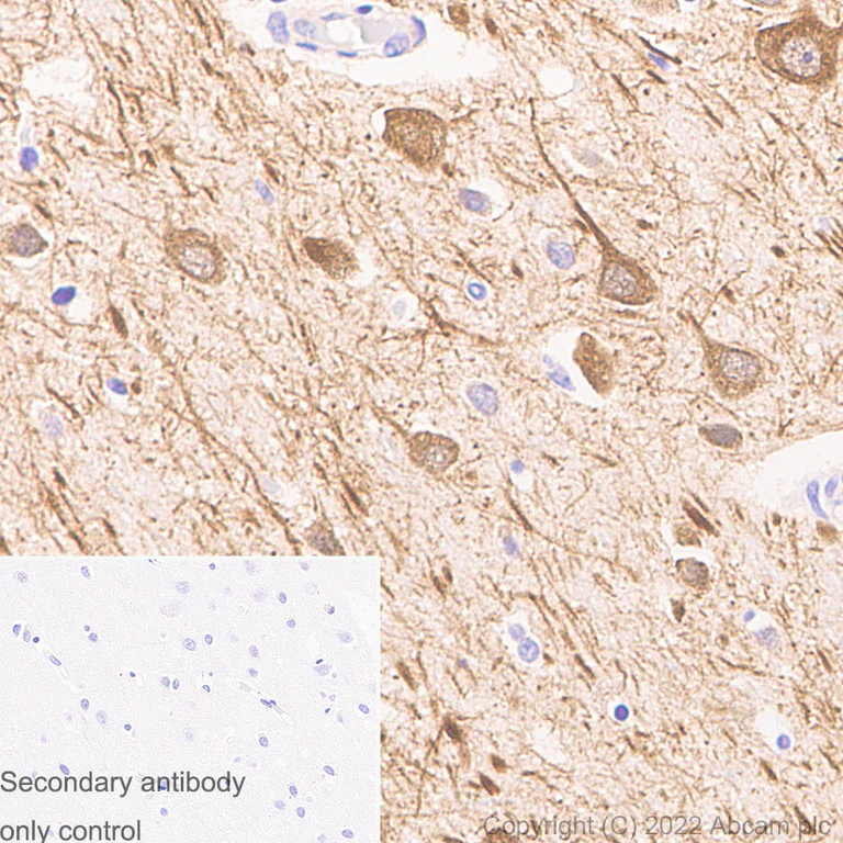 Immunohistochemistry (Formalin/PFA-fixed paraffin-embedded sections) - Anti-MAP2 antibody [EPR19691] - Mouse IgG2a (Chimeric) - BSA and Azide free (AB300646)
